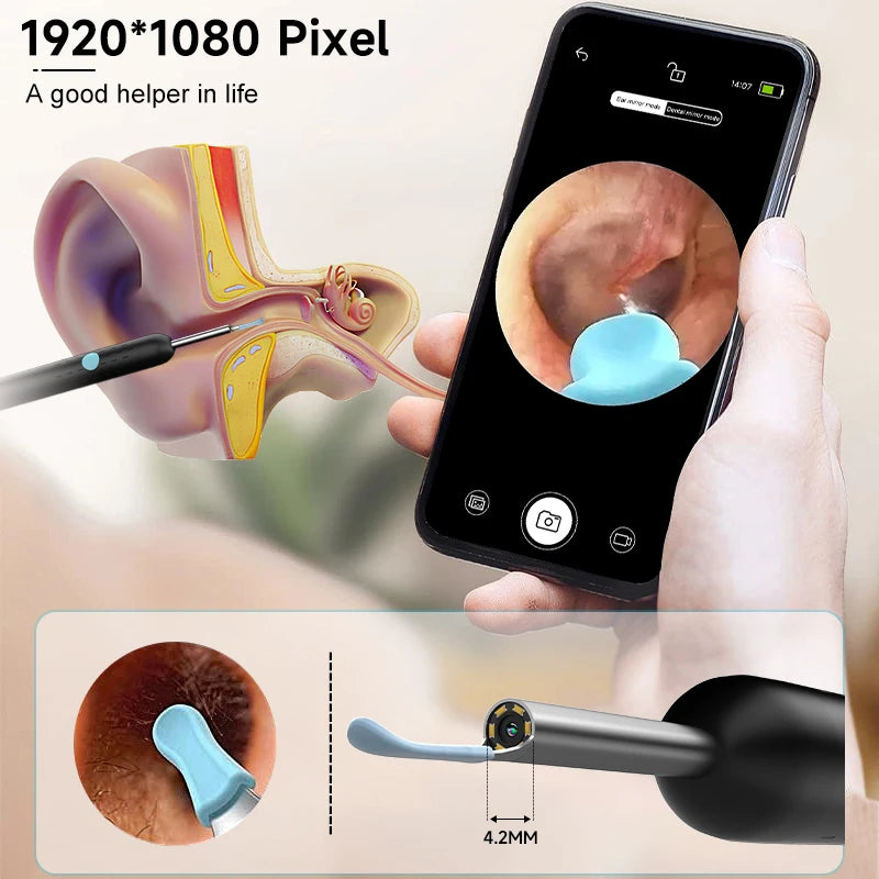 Wireless Earsight Visual Ear Wax Cleaner